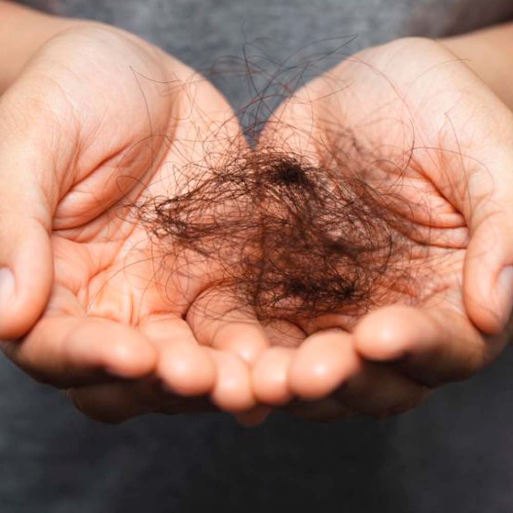Pack 4 Champú Sólido Anticaída y Fortalecedor - 100% Natural - Todo Tipo de Cabello - Con Aceite de Ricino - Image 2