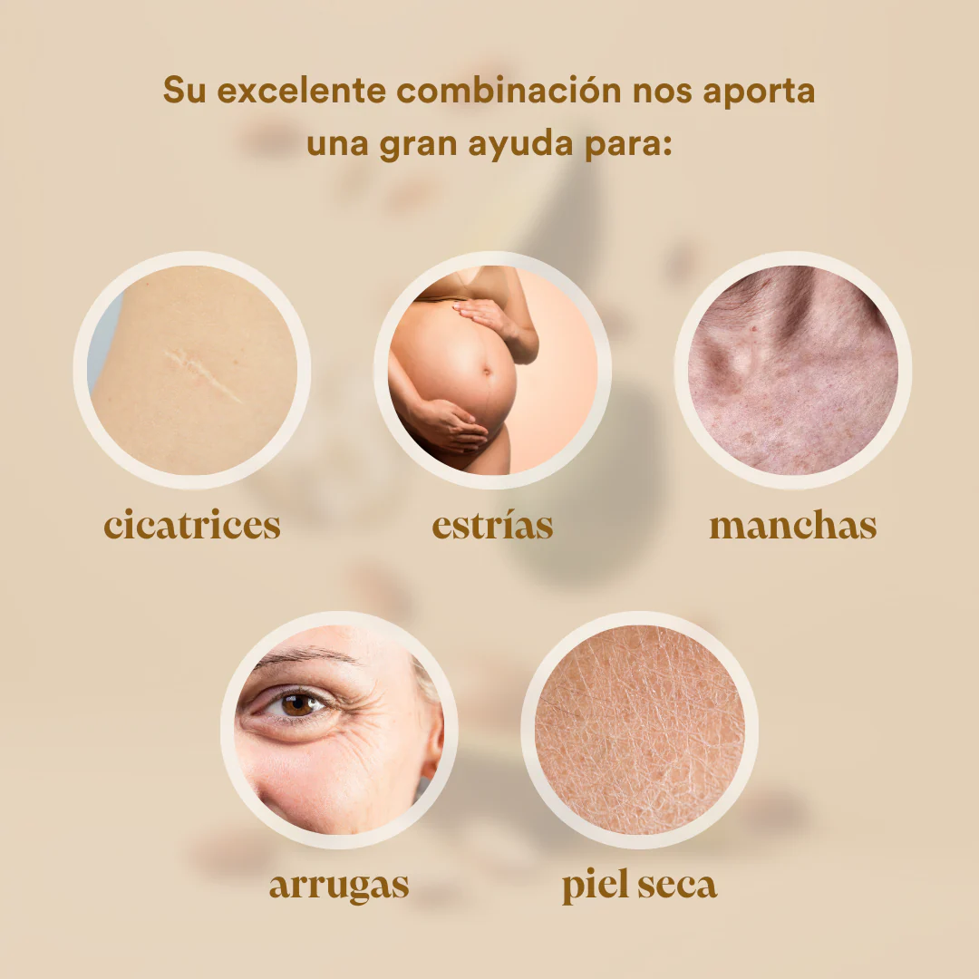 QKnatur - Aceite Corporal All In One - 200ml - Mejora La Apariencia De Cicatrices | Prevención De Manchas Y Estrías - Image 3